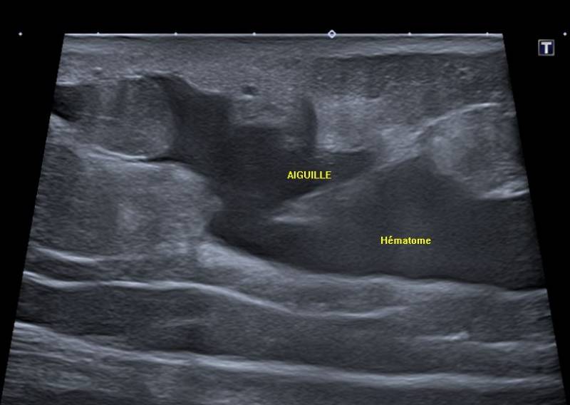 découvrez l'univers fascinant de l'imagerie 3d, une technologie révolutionnaire qui transforme la visualisation des données et crée des expériences immersives inoubliables. apprenez-en davantage sur ses applications dans divers secteurs, de l'architecture à la médecine.