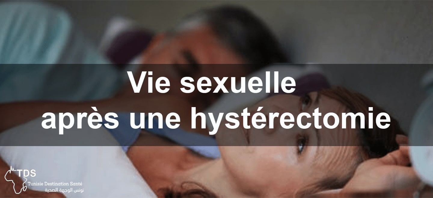 Conisation du col durée de repos et conseils postopératoires essentiels — free download