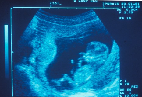 découvrez les enjeux du déficit médical à garlin, ses conséquences sur la santé des habitants et les solutions envisagées pour améliorer l'accès aux soins dans cette commune.