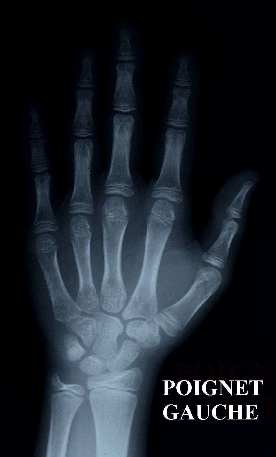 découvrez comment la croissance physique et développementale peut se poursuivre après les premières règles chez les adolescentes, ainsi que les facteurs influençant cette évolution.