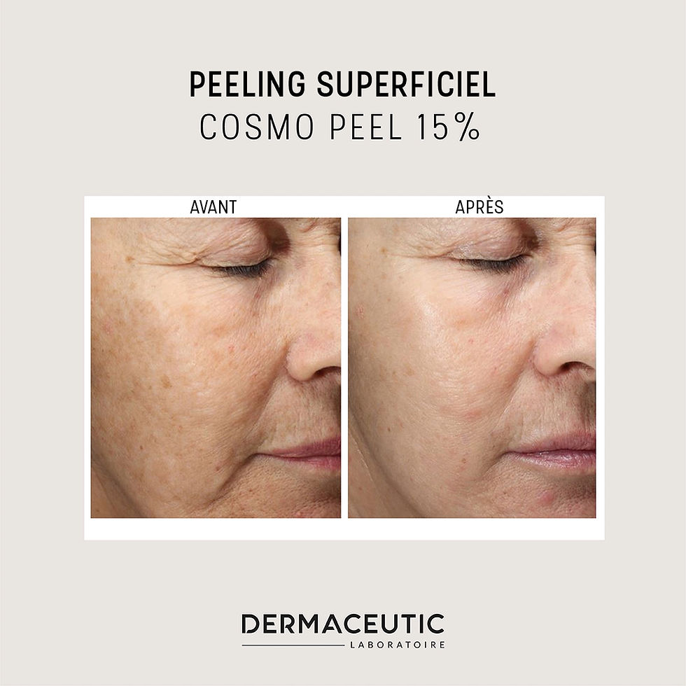 découvrez tout ce qu'il faut savoir sur le peeling phénol : ses risques potentiels, les contre-indications à connaître et les précautions à prendre pour un soin en toute sécurité. obtenez des conseils d'experts et informez-vous sur les alternatives disponibles.