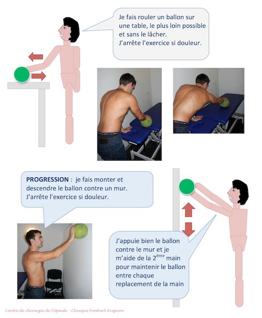 découvrez la durée d'arrêt recommandée après une blessure à la coiffe des rotateurs pour une récupération optimale et sécurisée.