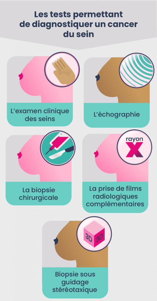 découvrez notre guide complet sur l'échographie axillaire, une technique d'imagerie médicale essentielle pour évaluer les structures de l'aisselle, diagnostiquer et suivre diverses pathologies.