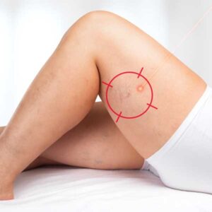 découvrez les tarifs de la chirurgie esthétique avec le dr barazer à nîmes, spécialiste reconnu dans le gard. des soins sur mesure pour votre bien-être et beauté.